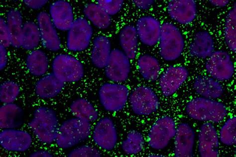 How you derive embryonic stem cells matters | The Stem Cellar