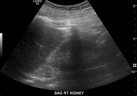 Dr Shannon’s Ultrasound Corner