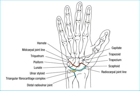 Ulnar Wrist Pain Causes