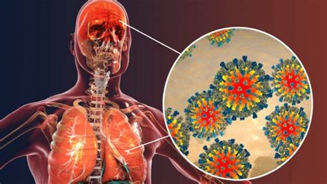 How measles impacts your immune system