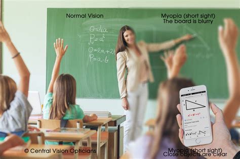 What does it mean to be short sighted (myopic)? - Finchley's Multi ...