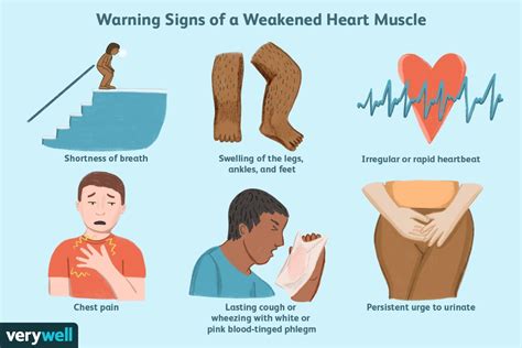 Signs of a Weak Heart and Common Causes Signs Of Heart Failure, Causes Of Heart Failure, Signs ...