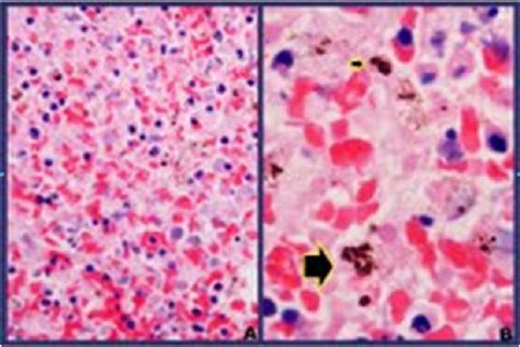 Microscopic examination of the spleen (H&E stain) showing (A) splenic... | Download Scientific ...