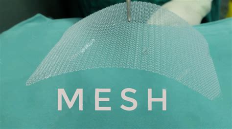 Hernia Mesh Implants - Hype.News: Free online Newsroom platform ...