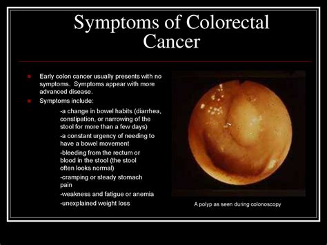 Blood In Stool Colon Cancer