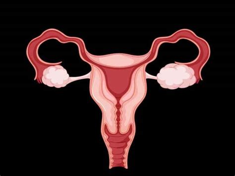 Ovarian Fibroma: Is It Ovarian Cancer?