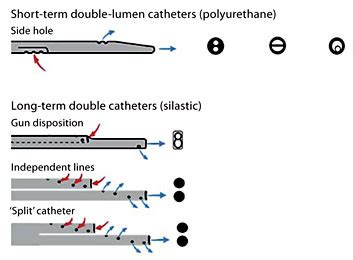 Temporary Hemodialysis Catheter