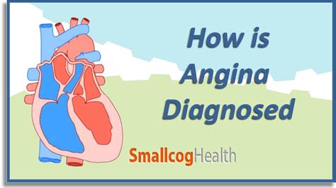 How is Angina Diagnosed - YouTube smallcogbigmachine - 9 regions of the ...