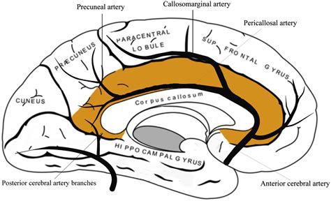 Cingulate infarction: A neuropsychological and neuroimaging study ...