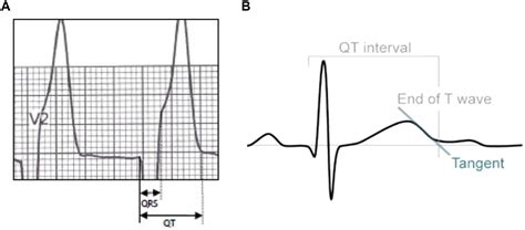 Frontiers | The ECG Characteristics of Patients With Isolated ...