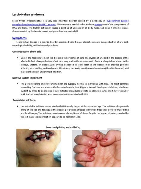 Lesch-Nyhan syndrome-WPS Office | PDF | Genetics | Medicine