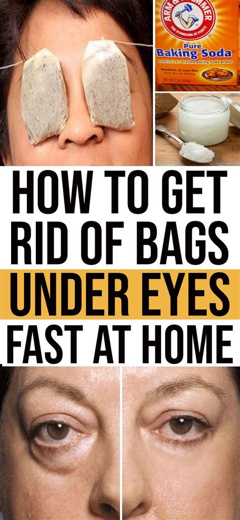 How To Get Rid Of Eye Bags Tea at Matthew Carey blog