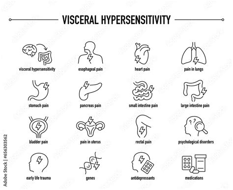 Visceral Hypersensitivity symptoms, diagnostic and treatment vector ...