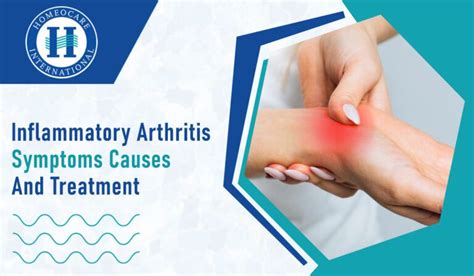 Inflammatory arthritis symptoms causes and treatment ‣ Arthritis ...