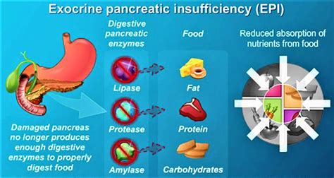 √70以上 exocrine pancreatic insufficiency poop 847963-Exocrine pancreatic insufficiency puppy