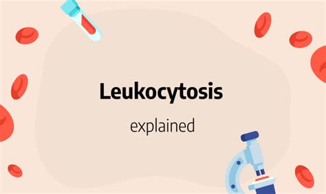 Leukocytosis: definition, causes, symptoms and treatments