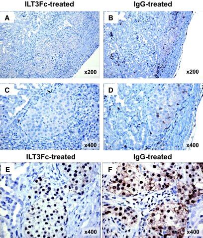 Immunostaining of CD8+ T-cells (A–D) and CD40 (E and F) in ...