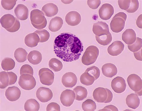 Eosinophil Under Microscope