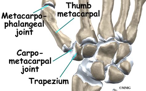 CMC Fusion: Thumb Fusion | Houston Methodist