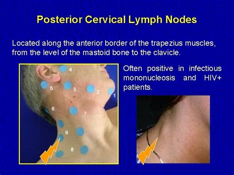 Lymph Nodes Examination Examination of the Lymphatic System