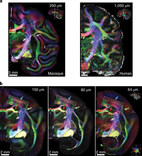 The corona radiata imaged at different spatial resolutions a, Coronal ...