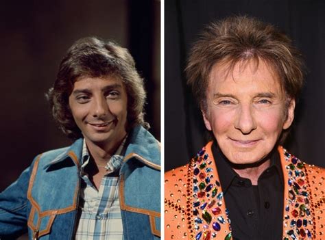 Barry Manilow Before and After Plastic Surgery