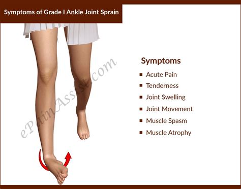 Ankle Sprains Causes And Symptoms Ankle Sprain Grades - vrogue.co