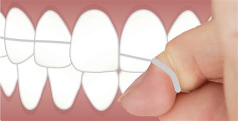 Proper Flossing Techniques | Burlington Dental Centre