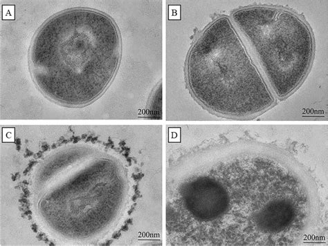 Morphological structure of S. aureus observed by Polygonum chinense ...