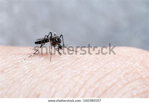 Aedes Mosquito Bite On Skin Mosquito Stock Photo (Edit Now) 560380507