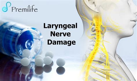 Laryngeal Nerve Damage - Premilife - Homeopathic Remedies