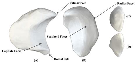 6: Bony Anatomy of the Lunate. Bony anatomy of the left lunate with... | Download Scientific Diagram