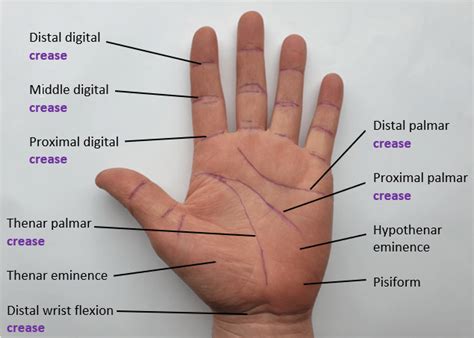 Landmarks of the palmar hand. | Download Scientific Diagram