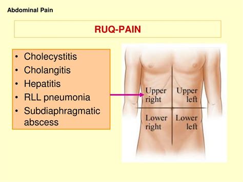 PPT - Approach To Abdominal Pain PowerPoint Presentation, free download - ID:6029208