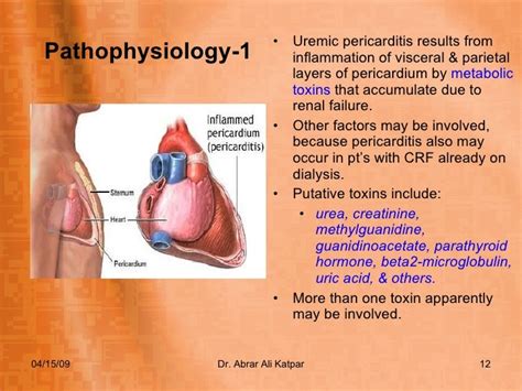 Uremic Pericarditis