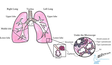 Lung Cancer Cell Diagram