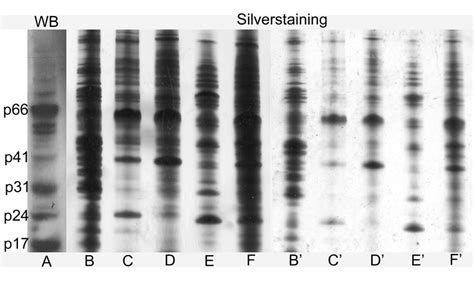 Silver staining of lentiviral vector preparations. Lentiviral vectors ...