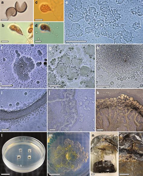 Fuligo septica AH 45741 (after the flight). (a) Germinated spores ...