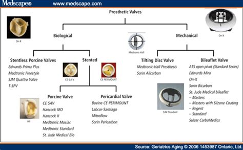 Jewels of Clinical Medicine: Types of Prosthetic Heart Valves