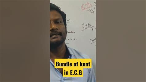 Bundle of kent in E.C.G | #shorts #neetbiology #ecg #neettamil #neetexam #neet #neetzoology ...