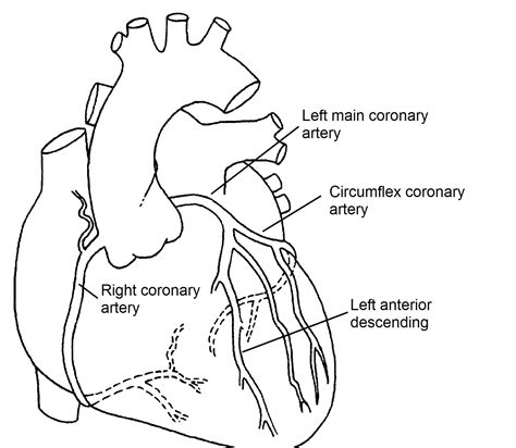 Normal Coronary Arteries - Pediatric Heart Specialists