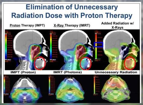 Proton Therapy: What Works - Engiomed : Medical Equipment Trading L.L.C.