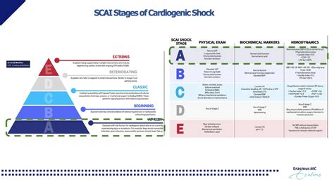 [Vídeo] PulseCath BV en LinkedIn: SCAI Classification Stages of Cardiogenic shock and the use of ...