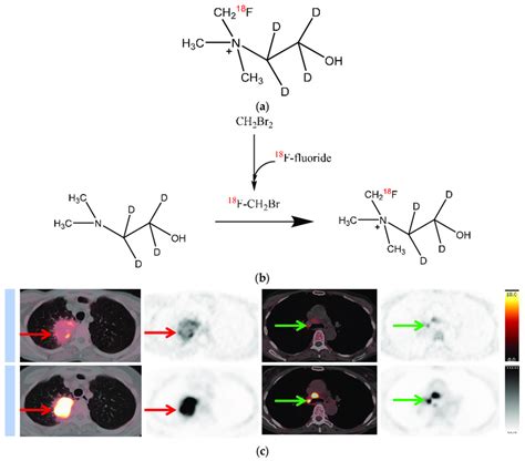 Chemical structure and synthesis of [ 18 F]D4-FCH, and images of [ 18 ...