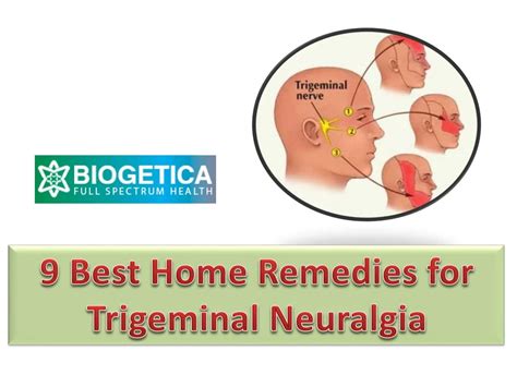 PPT - 9 Best Home Remedies for Trigeminal Neuralgia - Biogetica ...