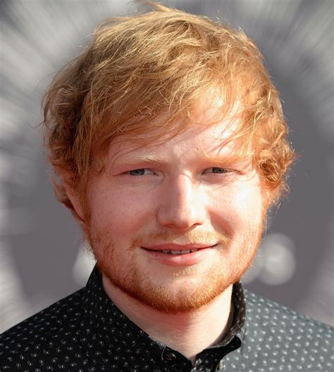 Ed-Sheeran-1 - Celebrities hair transplants