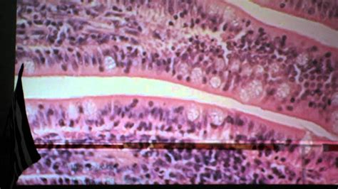 GI TRACT HISTOLOGY 1 - YouTube