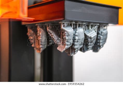 870 3d Printing Dentures Images, Stock Photos & Vectors | Shutterstock