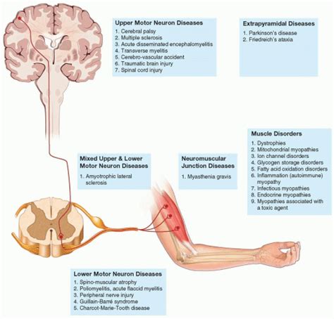 Neuromuscular Diseases | Musculoskeletal Key