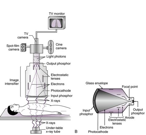 Fluoroscopy system | Radiology student, Medical radiography, Radiology ...